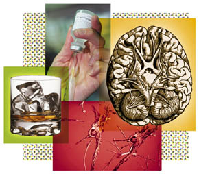 brain/alcohol illustration